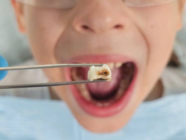 Best Urgent Tooth Repair  in New Braunfels, TX